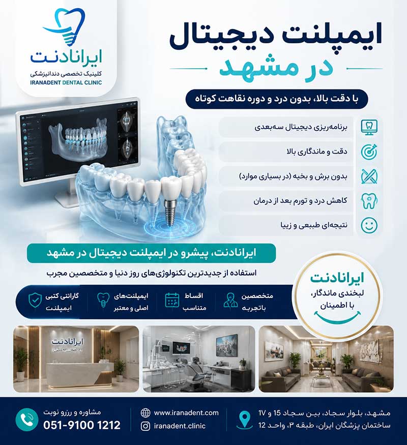 چه عواملی بر قیمت ایمپلنت دندان تاصیر میگذارد.