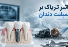 تأثیر تریاک بر ایمپلنت دندان و خطرات دود تریاک برای سلامت ایمپلنت
